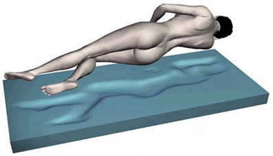 Druckentlastung Gel und Gelschaum